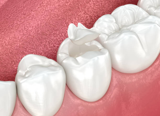 Our Range of Dental Services in South Venice, FL